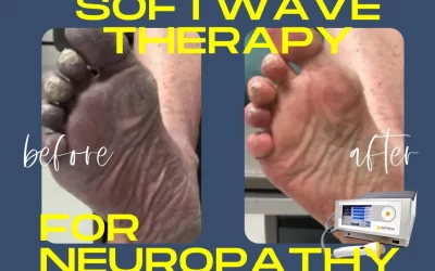 Cincinnati Neuropathy Treatment – SoftWave Therapy