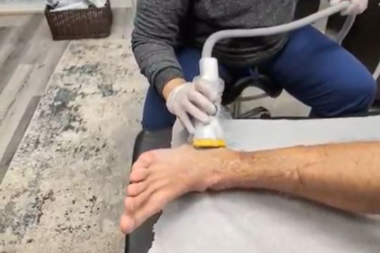 How SoftWave Therapy’s Electrohydraulic Sound Waves Heal Your Body