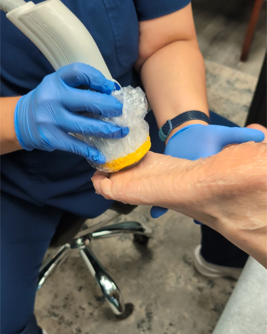 Close-up of a clinician performing SoftWave shockwave therapy on a patient's foot for neuropathy.
